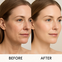 Crème Visage Anti-Âge et Éclaircissante à la Centella et à la Bave d'Escargot, Efficace et Puissante, à Marque Blanche, enrichie en Niacinamide pour Éliminer les Boutons