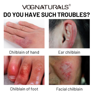 Private Label riparazione del tallone incrinato RainForces la <span class=keywords><strong>crema</strong></span> naturale <span class=keywords><strong>per</strong></span> il trattamento dei bambini - Product Image 2