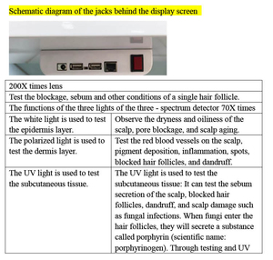 HDスカルプマイクロスコープアナライザー200Xタッチスクリーン付き頭皮問題検出三部鏡検査検査頭皮健康分析機 - Product Image 5