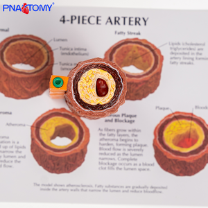 Modelo Anatómico Vascular de Cuatro Etapas para el Estudio de la <span class=keywords><strong>Enfermedad</strong></span> de <span class=keywords><strong>Arteriosclerosis</strong></span> Humana, Modelo de Vaso Arterial Humano, Regalo Educativo - Product Image 2