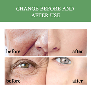 QBEKA Crème Hydratante <span class=keywords><strong>Visage</strong></span> Jour & Nuit Soin de la Peau Anti-âge et Séborégulatrice – Nouvelle Collection Beauté Tendance - Product Image 5