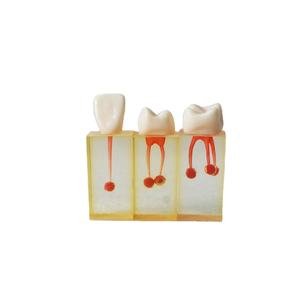 Levensgroot medisch onderwijsmodel van tanden, anatomisch model met kronen, voor tandheelkundig gebruik, menselijk oraal implantaat, tandheelkundig onderwijsmodel - Product Image 1