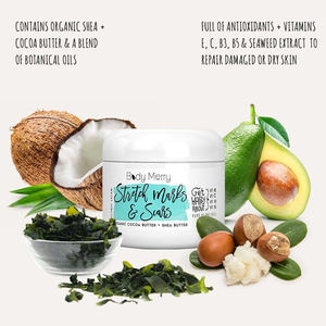 Crème réparatrice naturelle biologique à étiquette privée, anti-vergetures, réparation des vergetures, crème réparatrice des cicatrices, crème anti-vergetures de <span class=keywords><strong>grossesse</strong></span> - Product Image 4