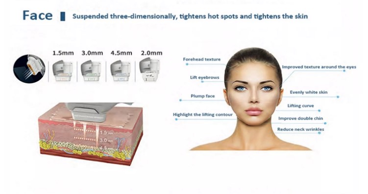 2022 2 Handle Dual Control 7D Hifu Machine For Skin Tightening And Body Slimming