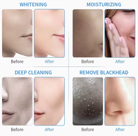 Appareil Facial "2 en 1" à Haute Pression avec Injecteur d'Eau et Jet Peel à Oxygène pour le Lifting Cutané