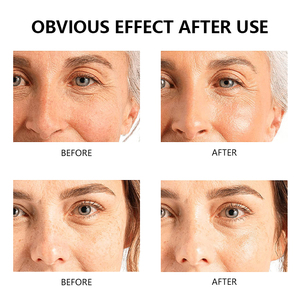 Crème hydratante <span class=keywords><strong>anti</strong></span>-rougeurs à marque privée avec acide hyaluronique, niacinamide et vitamine E pour tous types de peaux - Revitalisant cutané - Product Image 5