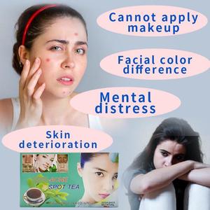 Té Herbal de Belleza para el Mercado Africano, Aclarante de Piel, Antienvejecimiento y Anti-Manchas, Venta al Por Mayor de Fábrica - Product Image 2