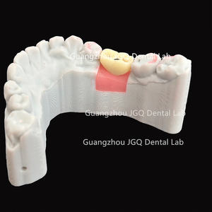 Dientes de cerámica de Zirconia completa <span class=keywords><strong>Implantes</strong></span> dentales Tornillo retenido China Buen <span class=keywords><strong>precio</strong></span> Dentaduras postizas - Product Image 4