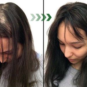 Cabello grueso y completo, ideal <span class=keywords><strong>para</strong></span> mujeres y hombres con cabello delgado, reduce las arrugas, líneas finas, suplemento <span class=keywords><strong>para</strong></span> el crecimiento del cabello - Product Image 4