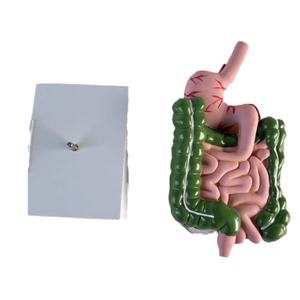 Un modèle de pathologie du système digestif humain dans le gros intestin - Product Image 4