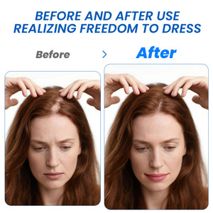 Crema e Unguento Sumifun per il Trattamento dell'Alopecia Areata con Erbe Naturali 20g Gel Ispessente per Uso Corporeo Uomini Donne - Product Image 4