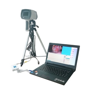 Harga Peralatan Medis Optik Imagex Colposcope, Vaginoskop Video Genggam - Product Image 5