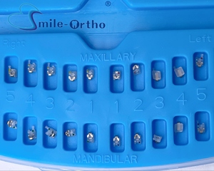 Nuovo Design ortodontico dentale attivo in ceramica staffa di legatura automatica con Clip in metallo bretelle dentarie trasparenti staffe estetiche - Product Image 4