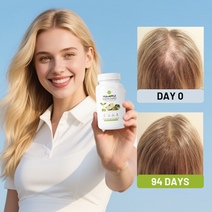 Suplemento Energético Herbal al por Mayor con Biotina de Alta Potencia Contra la Caída del Cabello - Product Image 2