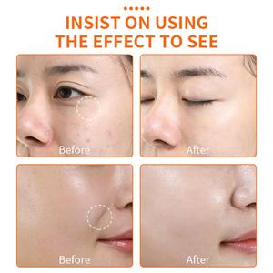 Crema Orgánica de Marca Privada para Aclarar la Piel Oscura, Eliminador de Manchas Oscuras, Crema Facial - Product Image 5