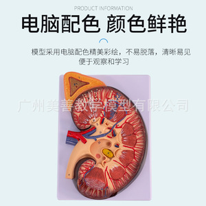 Modelo de anatomía del riñón humano, riñón y sistema urinario ampliados 2 veces, estructura del riñón y la glándula suprarrenal, modelo de riñón con enfermedades. - Product Image 1