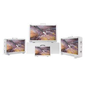 Dụng cụ phẫu thuật 32 inch 4K nội soi Hệ thống <span class=keywords><strong>camera</strong></span> với SDI/HDMI/DVI Kết quả đầu ra Đức chất lượng chống moire - Product Image 4