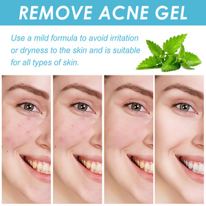 OUHOE Gel Réparateur Visage à l'Acide Salicylique Contre l'Acné, Estompe les Marques et Élimine les Points Noirs, Soin de la Peau 20g - Product Image 4