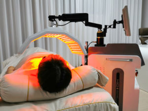 Máquina de Reparación de la Piel de Alto Rendimiento, para Piel Propensa al Acné, Antienvejecimiento, Aclaramiento de Manchas y Alivio de Quemaduras Solares (Rostro y Cuerpo) - Product Image 6