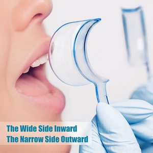 Écarteurs dentaires en plastique PC de qualité alimentaire 100 % sans BPA en forme de C pour blanchiment des dents, ouvre-<span class=keywords><strong>bouche</strong></span> intra-oral transparent/bleu clair - Product Image 6
