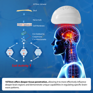 Casque de Neurofeedback à Thérapie par la Lumière 1070nm 40Hz, Machine de Photothérapie Transcrânienne pour la Dépression, l'Anxiété et le TDAH - Product Image 2