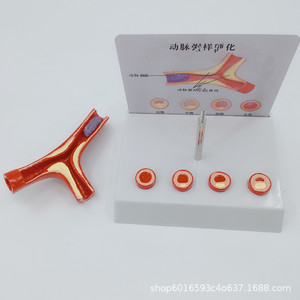 Modelo de anatomía vascular humana; modelo vascular; demostración de arteriosclerosis; vasos sanguíneos en diferentes etapas de edad. - Product Image 5