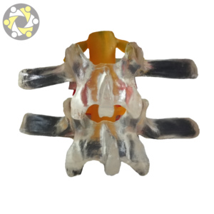 Sistema Esquelético D1101: Modelo de Demostración para la Enseñanza de Lesiones de la Columna Lumbar en <span class=keywords><strong>el</strong></span> <span class=keywords><strong>Cuerpo</strong></span> <span class=keywords><strong>Humano</strong></span> - Product Image 6
