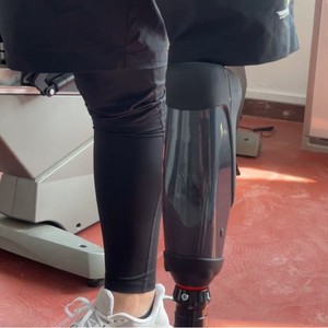 Prótesis <span class=keywords><strong>de</strong></span> rodilla ortopédica biónica totalmente inteligente Blechford <span class=keywords><strong>para</strong></span> amputación <span class=keywords><strong>de</strong></span> medio <span class=keywords><strong>pie</strong></span>, garantía <span class=keywords><strong>de</strong></span> por vida, clase <span class=keywords><strong>de</strong></span> miembro residual. - Product Image 4