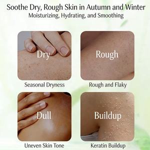 Ustom-iacinamida para el hogar, sistema de tratamiento de iacinamida para el hogar - Product Image 3