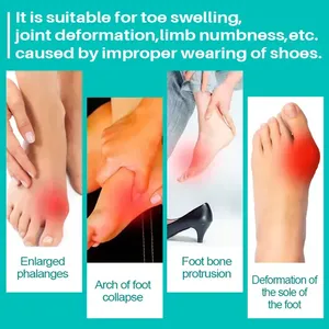Crème pour les douleurs articulaires à base d'ingrédients naturels, résultats rapides, soin des pieds, crème pour les douleurs aux orteils, soin des pieds, crème pour les bunions - Product Image 4