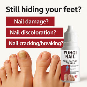 Factory wholesale Antifungal solution for toenails and fingernails to repair moisturizing <b>nail</b> essence - Product Image 4