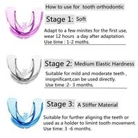 Accessoires de maquillage permanent (PMU) – Protège-dents orthodontiques personnalisés pour studio PMU