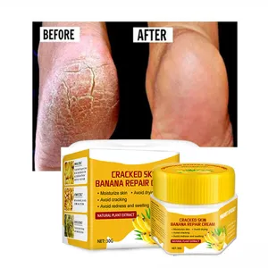 private label foot care repair cracking heel balm craked feet cream dead skin removal foot cream for cracked heels