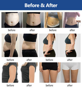 Cryo Double Chin Cryoshape Fat <strong>Cyrotherapy</strong> Body Freezing <strong>Machine</strong> - Product Image 6