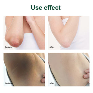 OEM-cuidado facial hidratante, elimina las ojeras, perla, aloe vera, elimina el <span class=keywords><strong>melasma</strong></span>, blanqueamiento, crema <span class=keywords><strong>para</strong></span> pecas, 50ml - Product Image 6