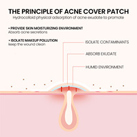Patchs anti-acné pour le visage, le nez et le corps - Idéal pour le dropshipping
