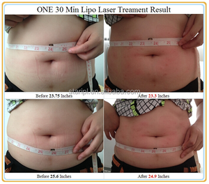 Popular 5D Lipo láser reducción de celulitis liposónico adelgazante cuerpo que forma la máquina de estiramiento de la piel para spa salón de uso doméstico - Product Image 5