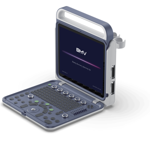 BMV BPU60C Veterinär-Ultraschall gerät 3D/4D Farb doppler S/W USB Wiederauf ladbar CE-zertifiziert Klasse II <span class=keywords><strong>2</strong></span> Jahre Garantie Kunststoff - Product Image 1