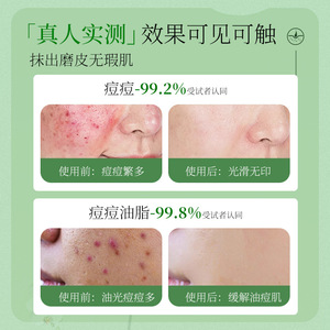 高品質ニキビ除去美容液 オリジナル液体 ニキビ跡を薄くし 毛穴を縮小 サリチル酸配合ニキビ除去美容液 - Product Image 4