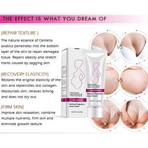 Meilleure qualité sûre effet 7 jours pour les femmes enceintes crème pour l'élimination des vergetures étiquette privée - Product Image 4