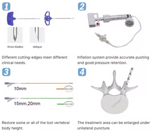 Ago professionale MOMO in titanio per puntura spinale per cifoplastica, vertebroplastica (PKP, PVP) di vertebre toraciche e lombari - Product Image 6