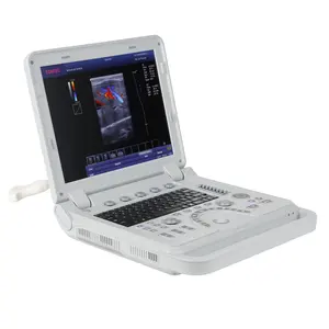 CONTEC CMS1700A Doppler de couleur humaine portable, système de Diagnostic à ultrasons, machine à ultrasons numérique