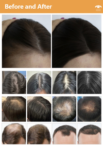 Free Tax Bioelectric <b>Vibration</b> Hair Care Machine Improving Hair Growth Environment and Preventing Hair Loss - Product Image 6