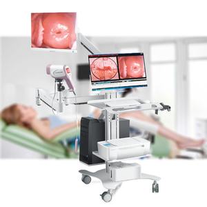 Hd Draagbare Vagina Colposcope Gynaecologie Gebruik Full Hd Digitale Video Colposcopie <span class=keywords><strong>Camera</strong></span> Voor Gynaecologie Onderzoek - Product Image 1