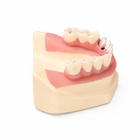 Modèle de pont dentaire de qualité médicale pour l'enseignement dentaire, avec couronne en zircone et prothèse implantaire, pour l'affichage