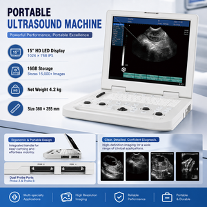Appareil d'échographie portable <span class=keywords><strong>de</strong></span> 4,2 kg avec 16 Go <span class=keywords><strong>de</strong></span> stockage, écran LED HD <span class=keywords><strong>de</strong></span> 15 pouces, scanner <span class=keywords><strong>de</strong></span> diagnostic vétérinaire avec deux ports pour sondes - Product Image 2