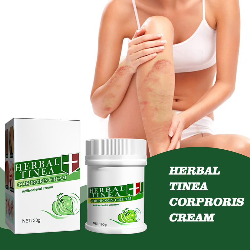 body cream itching care topical herbal tinea cream itching ringworm ointment