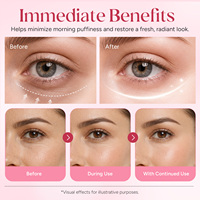 ATOANY Patchs Hydrogel PDRN Rétinol Rose Rafraîchissants pour les Yeux – Masque Anti-Âge Contre les Poches et les Cernes, Éclaircissant et Raffermissant