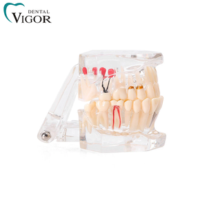 Modèle dentaire transparent pour l'enseignement de la pathologie dentaire avec dents amovibles pour la démonstration de prothèses - Product Image 4