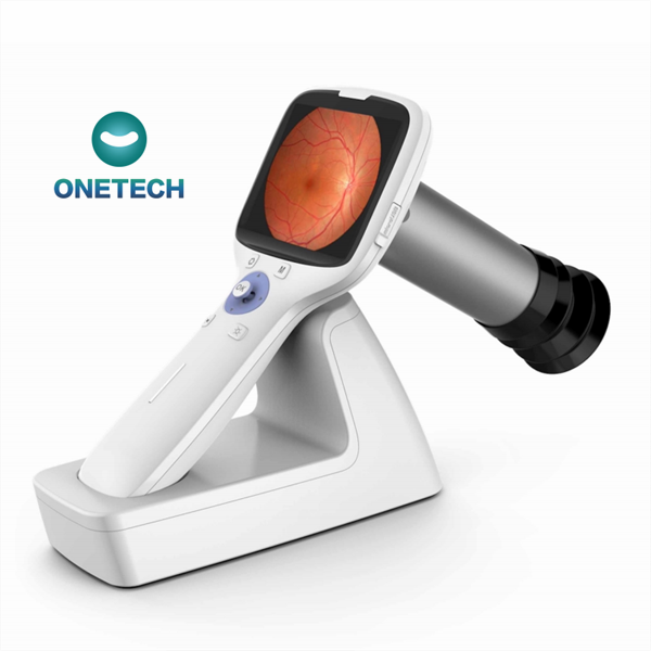 3.5inch 45 FOV Portable Veterinary Human Retinal Camera Handheld NFC1000 for Eye Examination Non Mydriatic Fundus Imaging Device